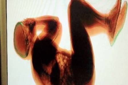 hangover_9-body-scan