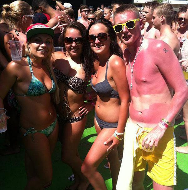 a-friendly-and-painful-reminder-to-wear-sunscreen-this-weekend-27-photos-23