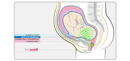 Идеалният подарък за Йордановци и Ивановци - вагинални тонколони