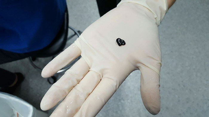 Жена плати 900 лева, за да спаси златната си рибка от задавяне